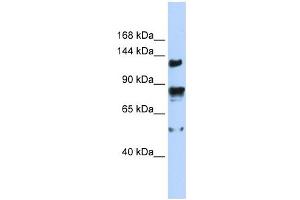 TRPM4 antibody used at 1 ug/ml to detect target protein. (TRPM4 antibody  (N-Term))
