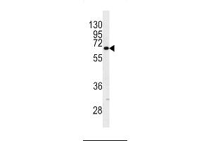 Western blot analysis of in NCI-H460 cell line lysates (35ug/lane) (KRT9 antibody  (AA 429-456))