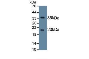 Detection of Recombinant SPINK5, Human using Monoclonal Antibody to Serine Peptidase Inhibitor Kazal Type 5 (SPINK5) (SPINK5 antibody  (AA 699-976))