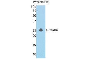 Western Blotting (WB) image for anti-Coiled-Coil Domain Containing 80 (CCD80) (AA 82-288) antibody (ABIN1176793) (CCDC80 antibody  (AA 82-288))