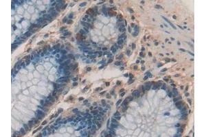 Immunohistochemistry (IHC) image for anti-Chitinase 3-Like 1 (Cartilage Glycoprotein-39) (CHI3L1) (AA 112-377) antibody (ABIN7433657)