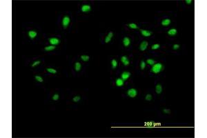 Immunofluorescence of purified MaxPab antibody to CUL4B on HeLa cell. (Cullin 4B antibody  (AA 1-913))