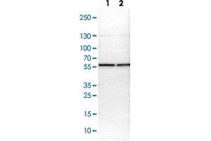 Western blot analysis of Lane 1: NIH-3T3 cell lysate (Mouse embryonic fibroblast cells) Lane 2: NBT-II cell lysate (Rat Wistar bladder tumour cells) with CCT2 polyclonal antibody  at 1:100-1:250 dilution. (CCT2 antibody)