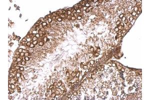 IHC-P Image RBP-Jkappa antibody [C1C3] detects RBP-Jkappa protein at cytosol on mouse testis by immunohistochemical analysis. (RBPJ antibody)