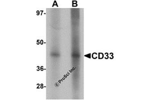 Western Blotting (WB) image for anti-CD33 (CD33) (Middle Region) antibody (ABIN1030903) (CD33 antibody  (Middle Region))