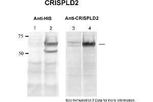 Sample type: 1. (CRISPLD2 antibody  (N-Term))