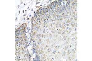 Immunohistochemistry of paraffin-embedded human esophagus using TMOD3 antibody (ABIN1683055, ABIN3019135, ABIN3019136 and ABIN6220733) at dilution of 1:100 (40x lens). (TMOD3 antibody  (AA 1-352))