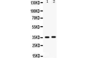 Western Blotting (WB) image for anti-FBJ Murine Osteosarcoma Viral Oncogene Homolog B (FOSB) (AA 264-291), (C-Term) antibody (ABIN3042399) (FOSB antibody  (C-Term))