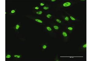 Immunofluorescence (IF) image for anti-Nuclear Mitotic Apparatus Protein 1 (NUMA1) (AA 1-1193) antibody (ABIN518467)