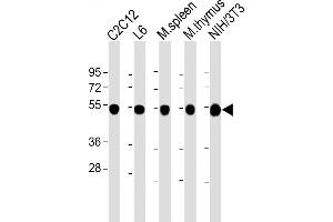 All lanes : Anti-beta Tubulin at 1:2000 dilution Lane 1: C2C12 whole cell lysate Lane 2: L6 whole cell lysate Lane 3: mouse spleen lysate Lane 4: mouse thymus lysate Lane 5: NIH/3T3 whole cell lysate Lysates/proteins at 20 μg per lane. (TUBB antibody  (AA 46-78))