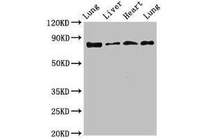 Western Blot Positive WB detected in: Rat lung tissue, Rat liver tissue, Mouse heart tissue, Mouse lung tissue All lanes: LOXL2 antibody at 3. (LOXL2 antibody  (AA 27-121))