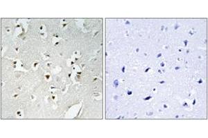 Immunohistochemistry (IHC) image for anti-PMS1 Postmeiotic Segregation Increased 1 (S. Cerevisiae) (PMS1) (AA 441-490) antibody (ABIN2890023) (PMS1 antibody  (AA 441-490))