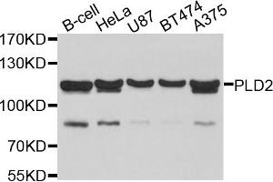 Western blot analysis of extracts of various cell lines, using PLD2 antibody. (Phospholipase D2 antibody)