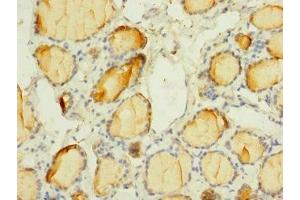 Immunohistochemistry of paraffin-embedded human thyroid tissue using ABIN7169924 at dilution of 1:100 (SCN3A antibody  (AA 274-400))
