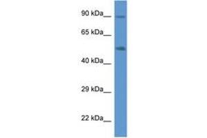 Image no. 1 for anti-Cytochrome P450, Family 2, Subfamily W, Polypeptide 1 (CYP2W1) (AA 260-309) antibody (ABIN6746908) (CYP2W1 antibody  (AA 260-309))