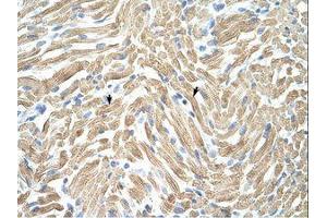 Image no. 1 for anti-Tropomyosin alpha-1 Chain (TM7) (AA 20-69) antibody (ABIN203350) (TM7 antibody  (AA 20-69))