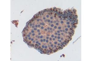 Used in DAB staining on fromalin fixed paraffin- embedded testis tissue (ABCA9 antibody  (AA 1416-1583))