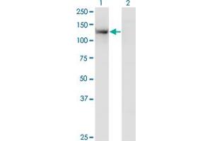 Western Blot analysis of TSHZ1 expression in transfected 293T cell line by SDCCAG33 monoclonal antibody (M07), clone 2F1. (TSHZ1 antibody  (AA 619-717))