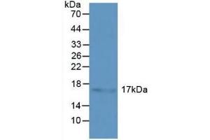 Detection of HSPb3 in Human Liver Tissue using Polyclonal Antibody to Heat Shock Protein Beta 3 (HSPb3) (HSPB3 antibody  (AA 1-150))