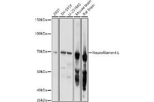 Western blot analysis of extracts of various cell lines, using Neurofilament L antibody (ABIN3020808, ABIN3020809, ABIN3020810 and ABIN6213733) at 1:1000 dilution. (NEFL antibody  (AA 400-543))