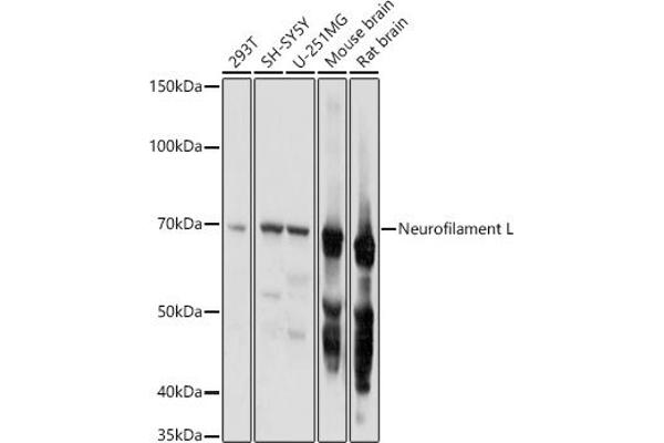 NEFL anticorps  (AA 400-543)