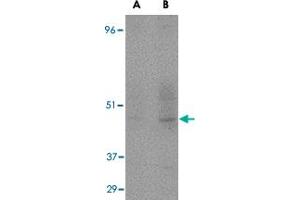 Western blot detection of CD209 fusion protein in human placenta at (A) 1 and (B) 2 ug/mL . (DC-SIGN/CD209 antibody)