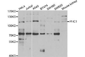 Western blot analysis of extracts of various cell lines, using PHC1 antibody. (PHC1 antibody)