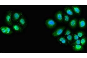 Immunofluorescent analysis of A549 cells using ABIN7144062 at dilution of 1:100 and Alexa Fluor 488-congugated AffiniPure Goat Anti-Rabbit IgG(H+L) (ZFAND6 antibody  (AA 1-208))