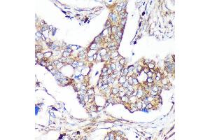 Immunohistochemistry of paraffin-embedded Human colon carcinoma using C Rabbit pAb (ABIN7266547) at dilution of 1:100 (40x lens). (CAND2 antibody  (AA 850-1000))