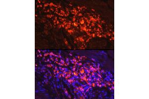 Immunofluorescence analysis of human colon carcinoma cells using Myeloperoxidase (MPO) Rabbit pAb (ABIN6128315, ABIN6143964, ABIN6143965 and ABIN6217844) at dilution of 1:50 (40x lens).