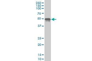 PHF1 monoclonal antibody (M05), clone 4F5 Western Blot analysis of PHF1 expression in A-431 . (PHF1 antibody  (AA 2-100))