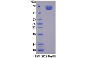 SDS-PAGE analysis of Human MYBPC3 Protein. (MYBPC3 Protein)