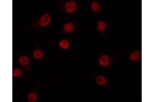 ABIN6266816 staining COS7 by IF/ICC. (XRN2 antibody)