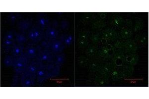IF analysis of Hela, diluted at 1:200.