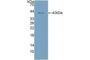 Detection of Recombinant CLEC4L, Human using Polyclonal Antibody to Cluster Of Differentiation 209 (CD209)