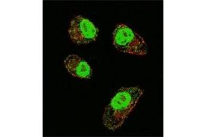 Immunofluorescence (IF) image for anti-Hypoxia Inducible Factor 1, alpha Subunit (Basic Helix-Loop-Helix Transcription Factor) (HIF1A) (AA 519-547) antibody (ABIN3031284)