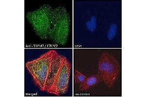 ABIN184611 Immunofluorescence analysis of paraformaldehyde fixed U2OS cells, permeabilized with 0. (TRPM7 antibody  (C-Term))