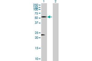 Western Blot analysis of AZIN1 expression in transfected 293T cell line by AZIN1 MaxPab polyclonal antibody. (Antizyme Inhibitor 1 antibody  (AA 1-448))