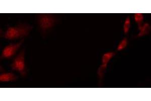 Immunofluorescence (fixed cells) (IF/ICC) image for anti-SMAD, Mothers Against DPP Homolog 2 (SMAD2) (pSer250) antibody (ABIN6256218)