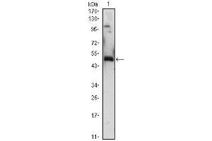 Western Blot showing EGR1 antibody used against EGR1 (AA: 282-433)-hIgGFc transfected HEK293 (1)cell lysate. (EGR1 antibody  (AA 282-433))