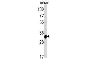 Image no. 1 for anti-ELOVL Fatty Acid Elongase 6 (ELOVL6) (N-Term) antibody (ABIN452952)