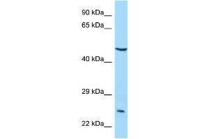 WB Suggested Anti-IL5RA Antibody Titration: 1.