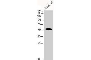 Western Blot analysis of HEPG2-UV cells using Actin α1 Polyclonal Antibody (Actin antibody  (N-Term))