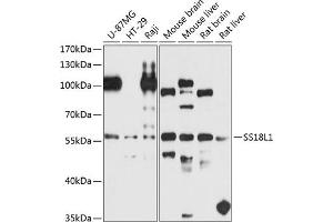 Western blot analysis of extracts of various cell lines, using SS18L1 antibody (ABIN6132117, ABIN6148475, ABIN6148476 and ABIN6224807) at 1:1000 dilution.