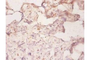 Immunohistochemistry of paraffin-embedded human placenta tissue using ABIN7160310 at dilution of 1:50 (ABCB1 antibody  (AA 236-297))