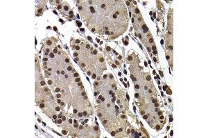 Immunohistochemistry of paraffin-embedded human stomach using GPS1 antibody (ABIN5974162) at dilution of 1/100 (40x lens).