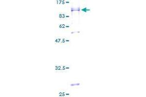 Image no. 1 for UBX Domain Protein 4 (UBXN4) (AA 1-508) protein (GST tag) (ABIN1324500) (UBXD2 Protein (AA 1-508) (GST tag))