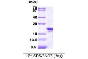Figure annotation denotes ug of protein loaded and % gel used. (Peroxiredoxin 2 Protein (PRDX2) (AA 1-198))