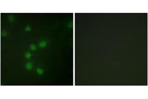 Immunofluorescence analysis of HuvEc cells, using Telomerase (Ab-227) Antibody. (TERT antibody  (AA 196-245))