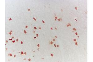 Formalin-fixed and frozen mouse cerebral cortex sections labeled with Anti-LMP2 Polyclonal Antibody, Unconjugated (ABIN680698) followed by conjugation to the secondary antibody (PSMB9 antibody  (AA 101-219))
